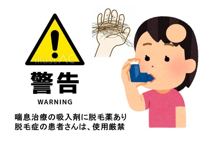 円形脱毛症　病院